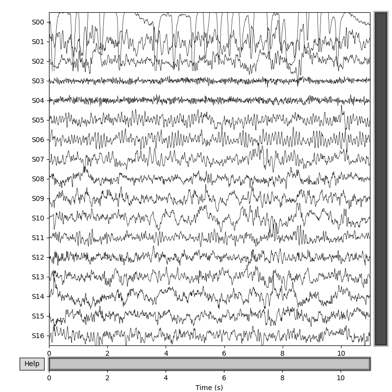 plot correct ajdc EEG